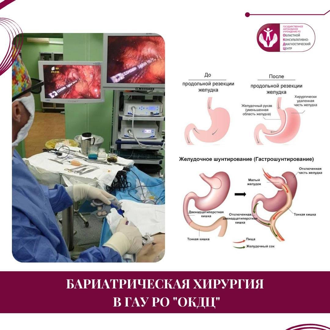 Бариатрическая Операция Оренбург Цена