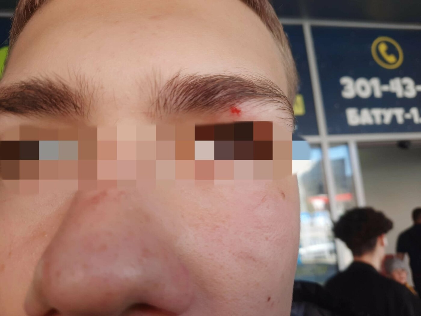 Раны на лице сына Ирины после нападения в ТЦ 